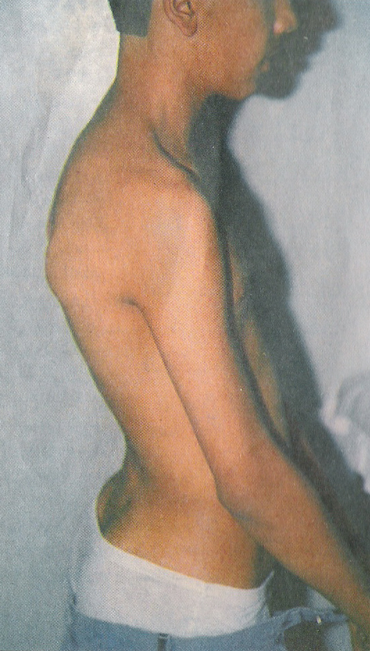 الحداب